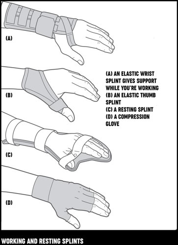 An illustration of different types of working and resting splints for hands and wrists.