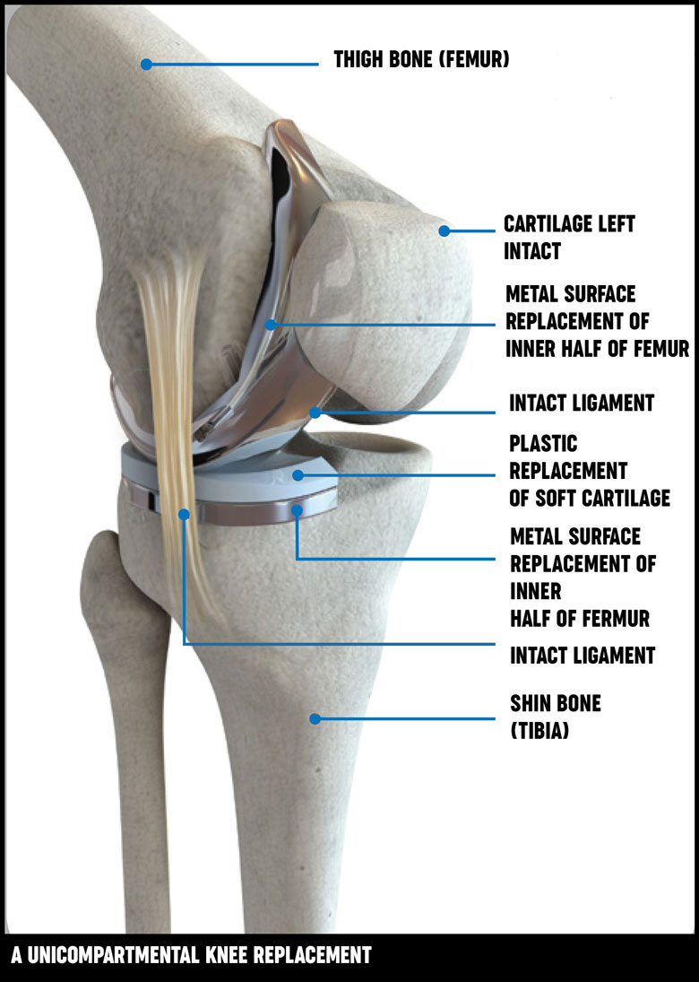 knee replacement pillow under knee