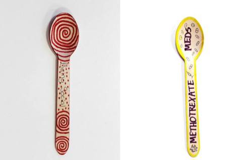 Two colourful spoons. One spoon is red with swirling patterns and reads 'being social'. The second spoon is bright yellow and reads 'Methotrexate. Meds'