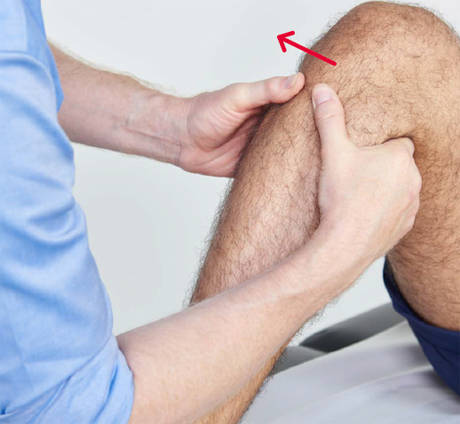 A medical professional performing an anterior draw test by placing both hands round the upper tibia, with your thumbs over the tibial tuberosity and index fingers tucked under the hamstrings to make sure these are relaxed and gently pull the upper tibia forward.