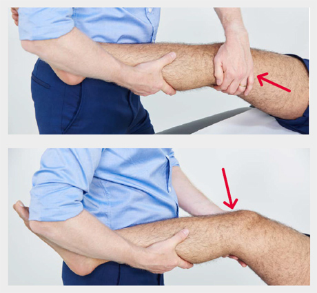 A medical professional assessing medial and lateral collateral ligament stability by flexing the knee to 15° and alternately stressing the joint line on each side by placing one hand on the opposite side of the joint line to that which you are testing and applying force to the lower tibia.