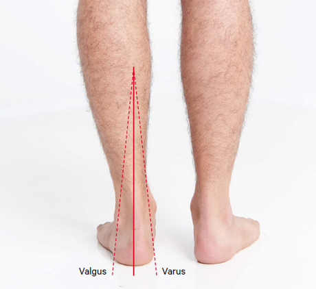 An image of the back of a gentleman's ankle and leg to check the valgus and varus.