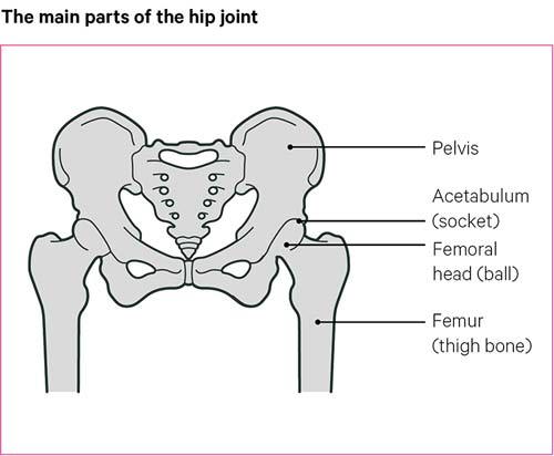Hip Replacement Surgery Treatment Options Versus Arthritis