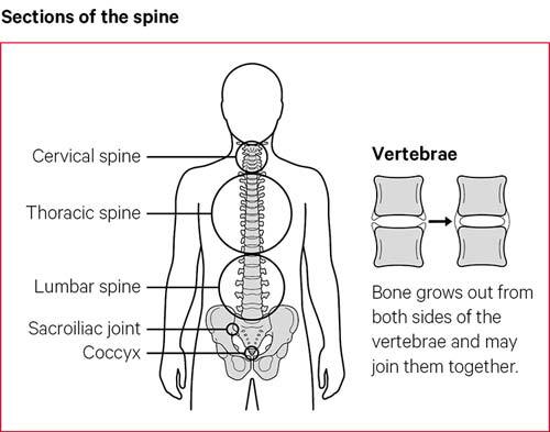 The sections of the spine consist of cervical, thoracic, lumbar spine, the sacroiliac joint and the cocyx.