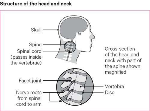 Back Pain Causes Exercises Treatments Versus Arthritis