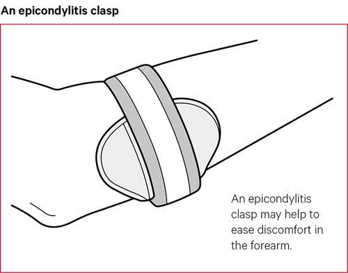 An epicondylitis clasp may help to ease discomfort in the forearm.