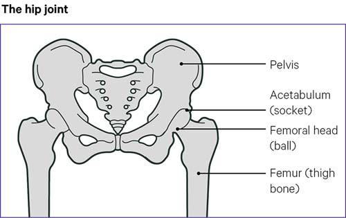 Osteoarthritis Oa Of The Hip Hip Pain Versus Arthritis Osteoarthritis Oa Of The Hip Hip Pain Versus Arthritis