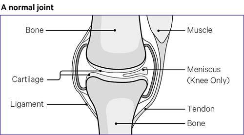 Knee Pain And Problems | Johns Hopkins Medicine