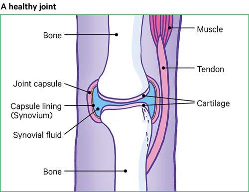 En frisk led utan skador på ben, brosk eller synovialmembran.