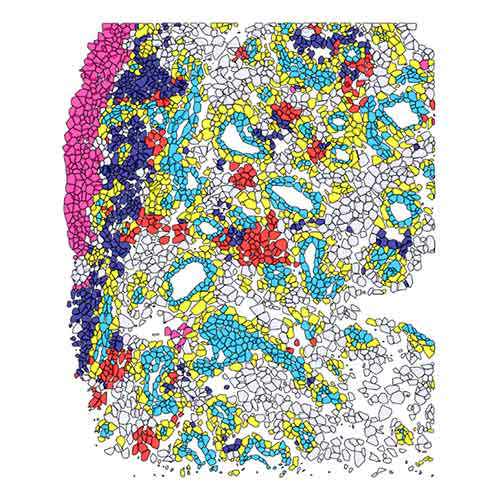 Graphic showing the mapping out of the networks of cells in a joint