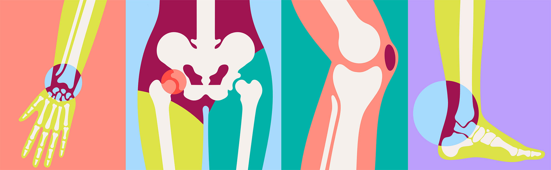 Graphic of joints